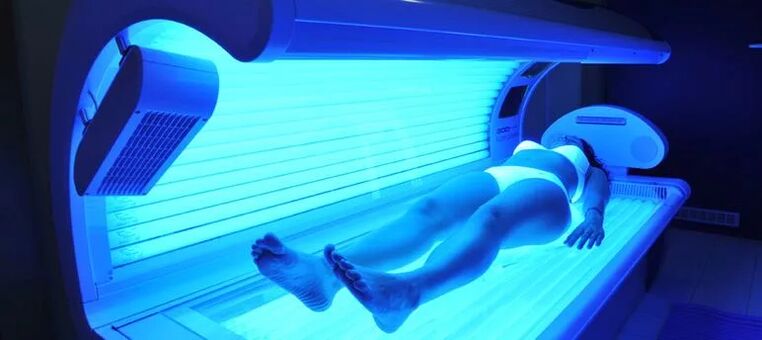 Féitheacha varicose agus solarium